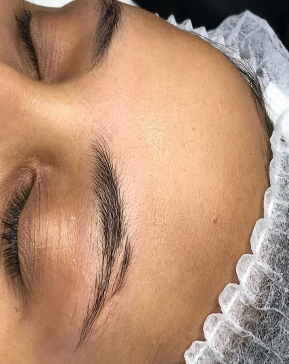 SIGNATURE SCAR